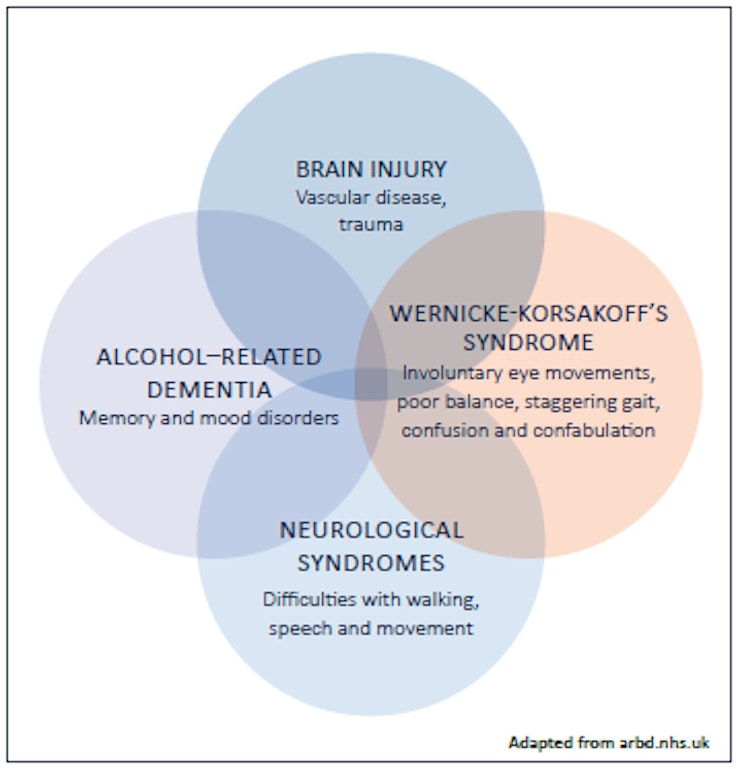 Alcohol Brain Damage >> Alcohol Related Brain Damage Quick Guide For Professionals Alcohol Brain Damage >> Alcohol Related Brain Damage Quick Guide For Professionals